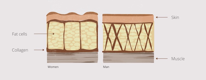 avoid cellulite